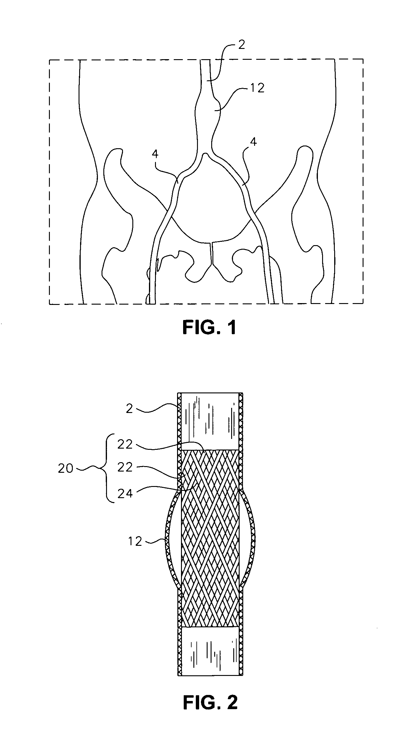 Devices and methods for AAA management