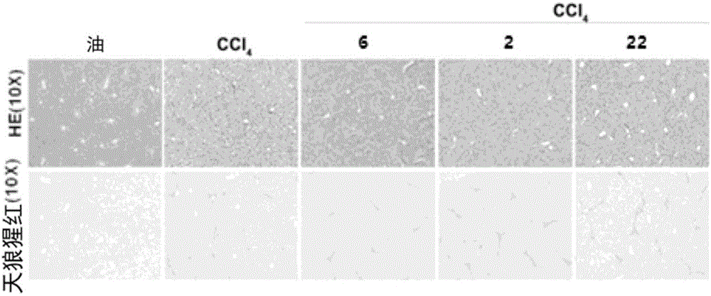 Application of GLP-1R/GCGR double-target agonist polypeptide to treatment of fatty liver diseases, hyperlipidemia and arteriosclerosis