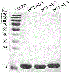 Natural nanometer antibody library for Bactrian camel phage display as well as construction method and usage thereof