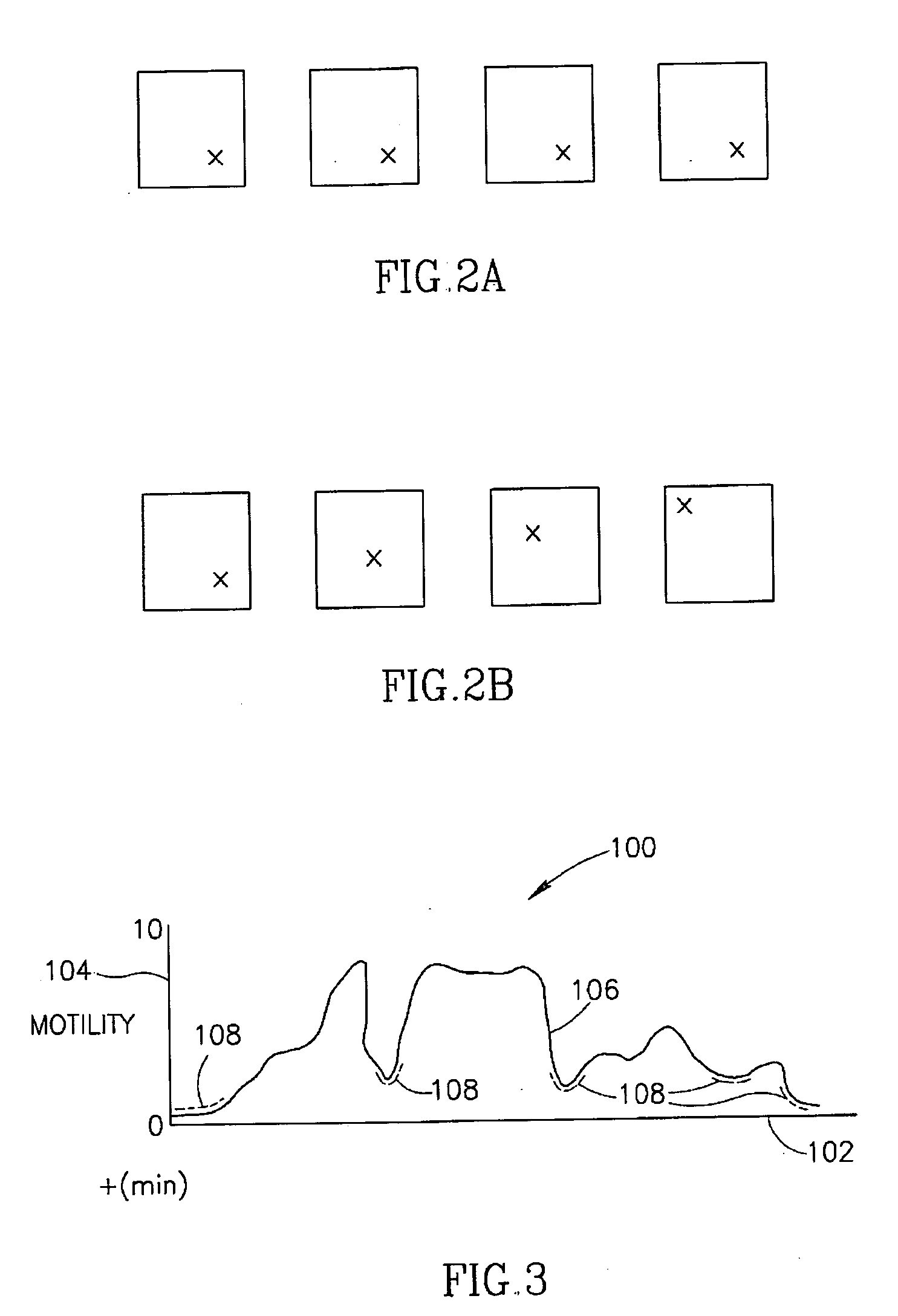 Motility analysis within a gastrointestinal tract