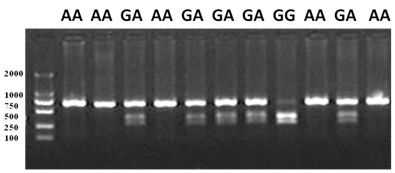 Molecular marker related to chicken carcass characters and acquisition method and application thereof