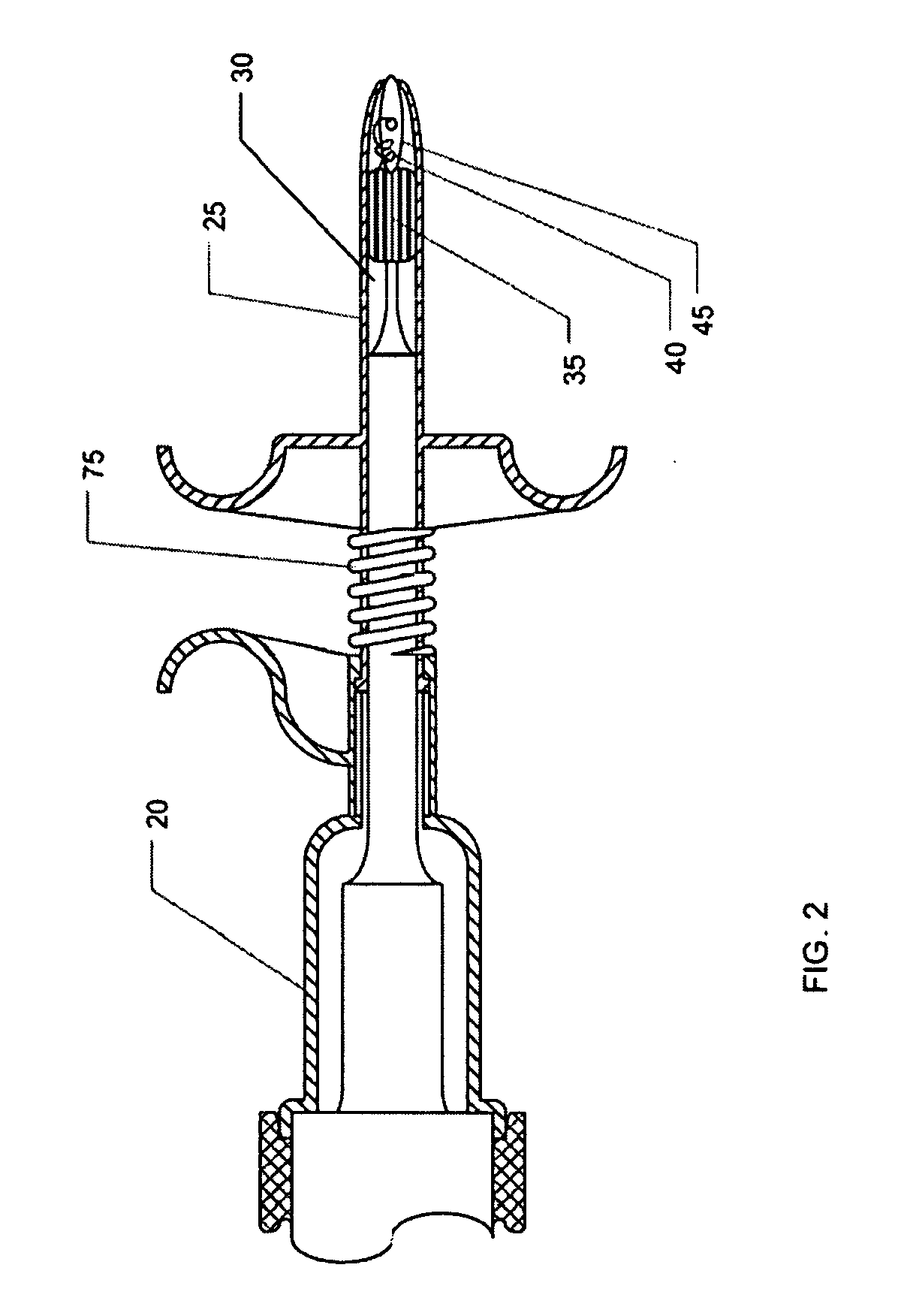 Ultrasonic vascular closure method