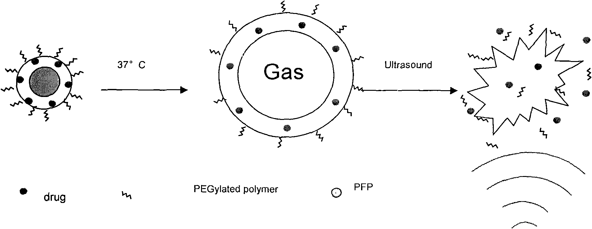 Ultrasound microbubble agent for treating tumors by low-intensity focused ultrasound and preparation method thereof