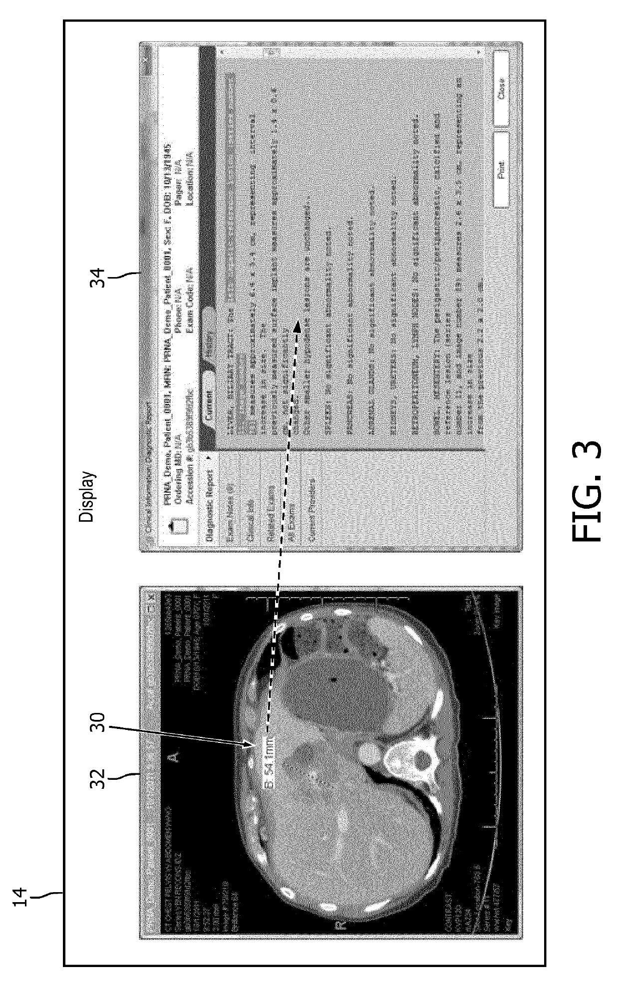 System and method for automatic detection of key images