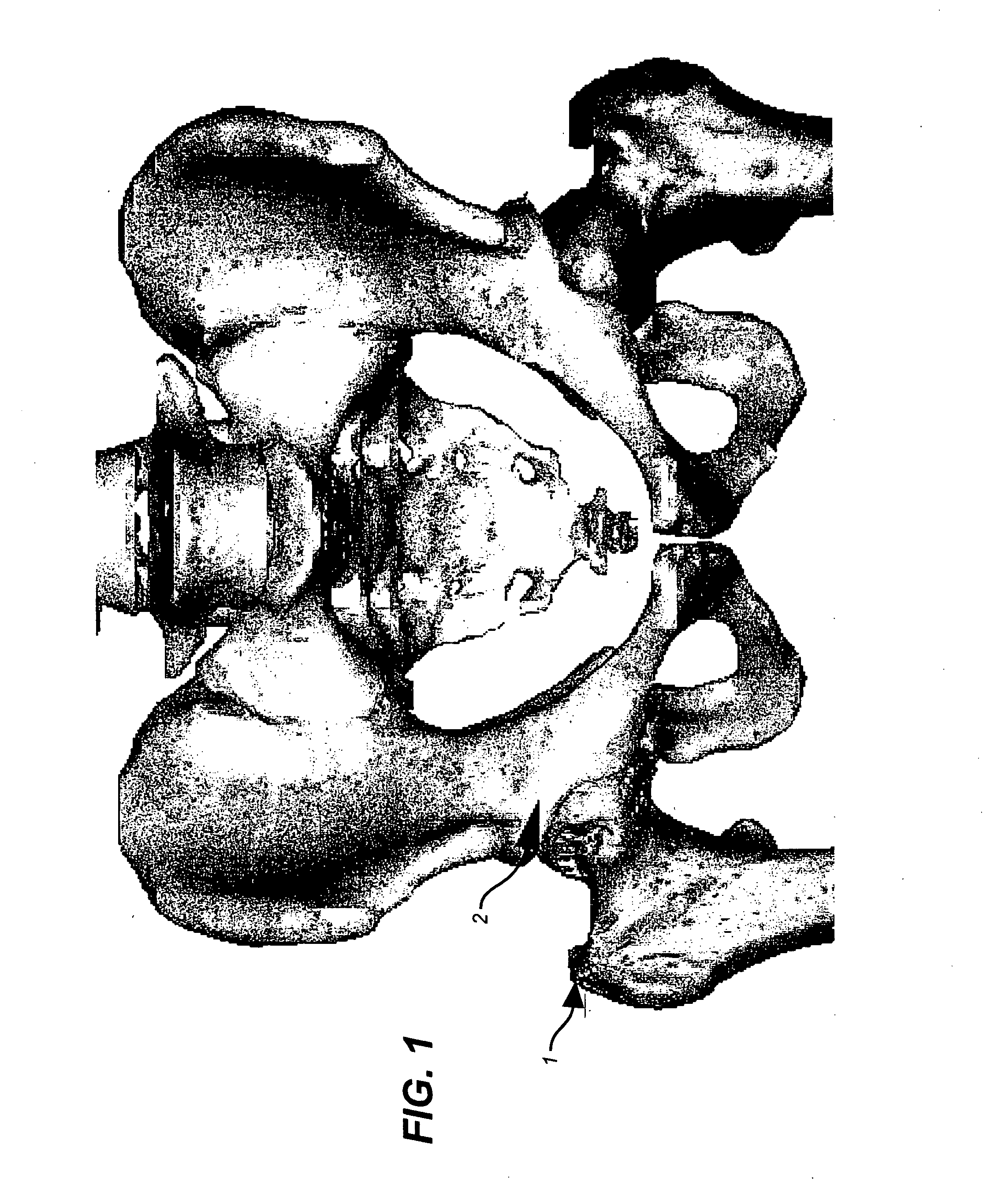 Device and method for allograft total hip arthroplasty