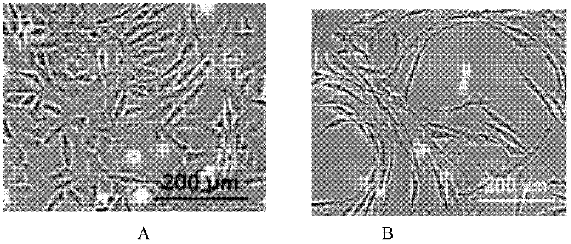 Separation culture method for cartilage stem cells