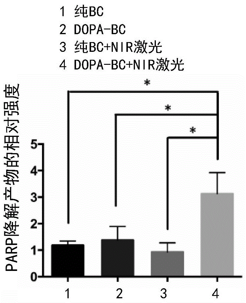 Biological ceramic scaffold with surface micro-nano structure and preparation method and application of biological ceramic scaffold with surface micro-nano structure