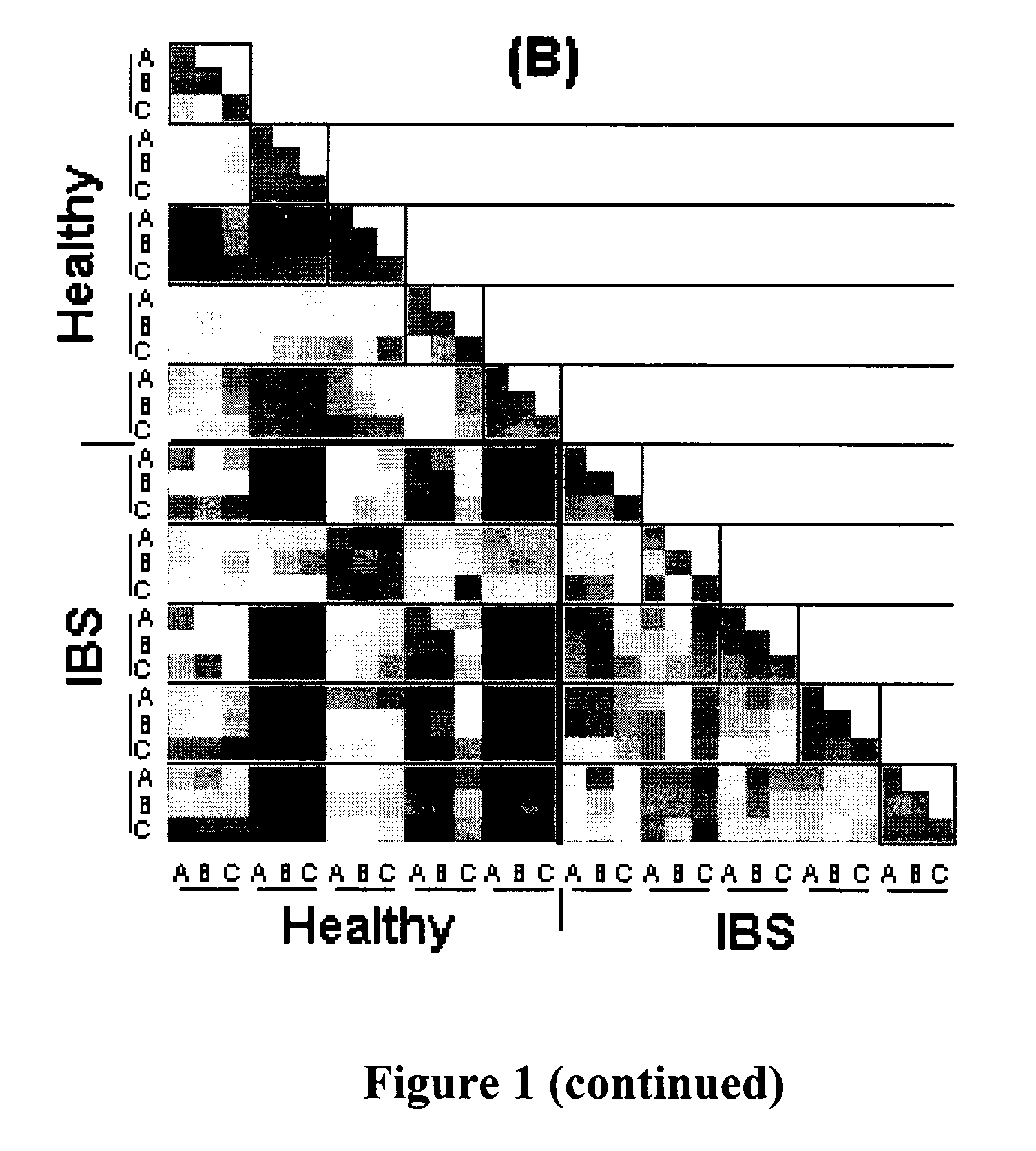 Compositions and methods for treating and diagnosing irritable bowel syndrome