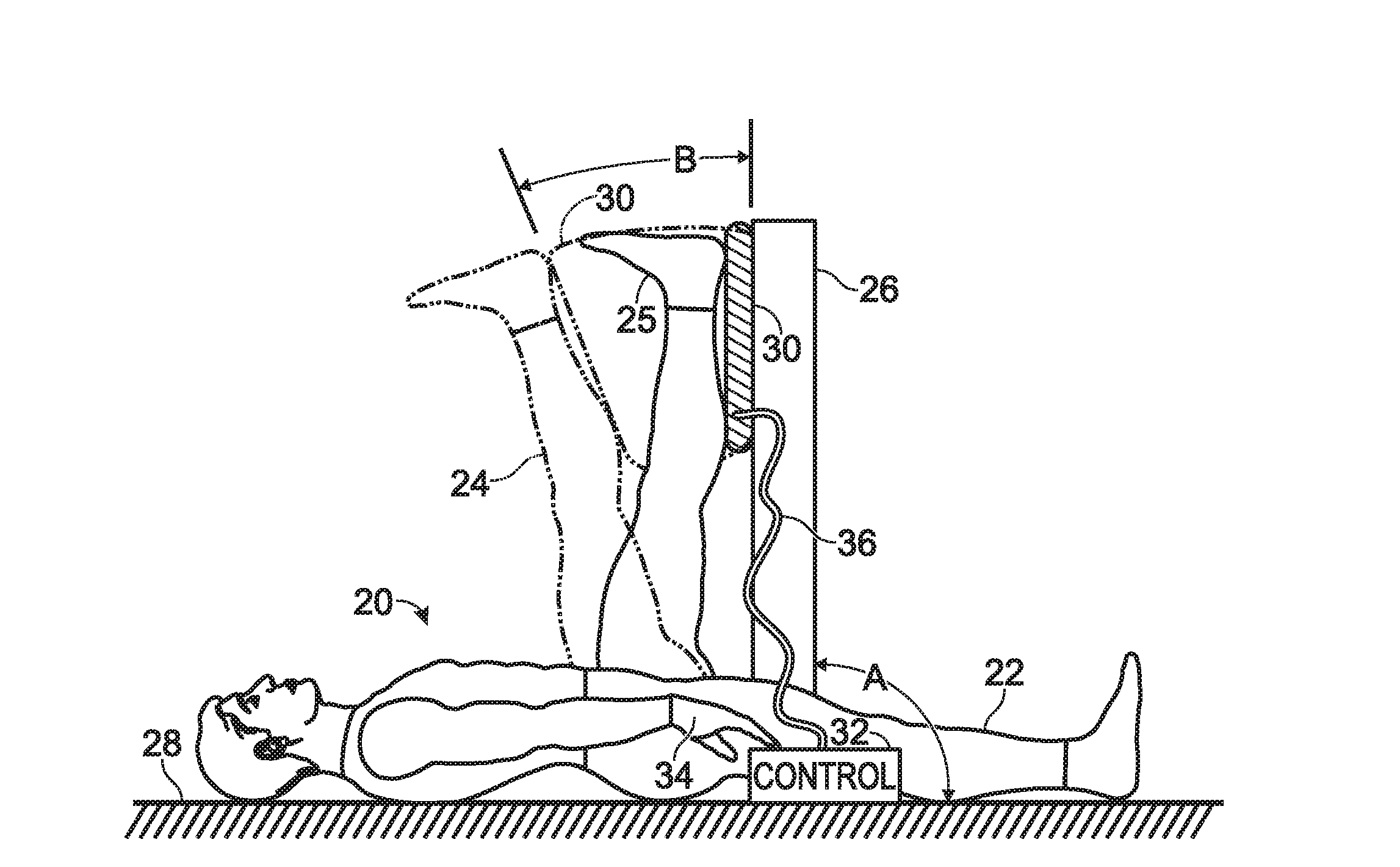 System for Knee Extension Therapy