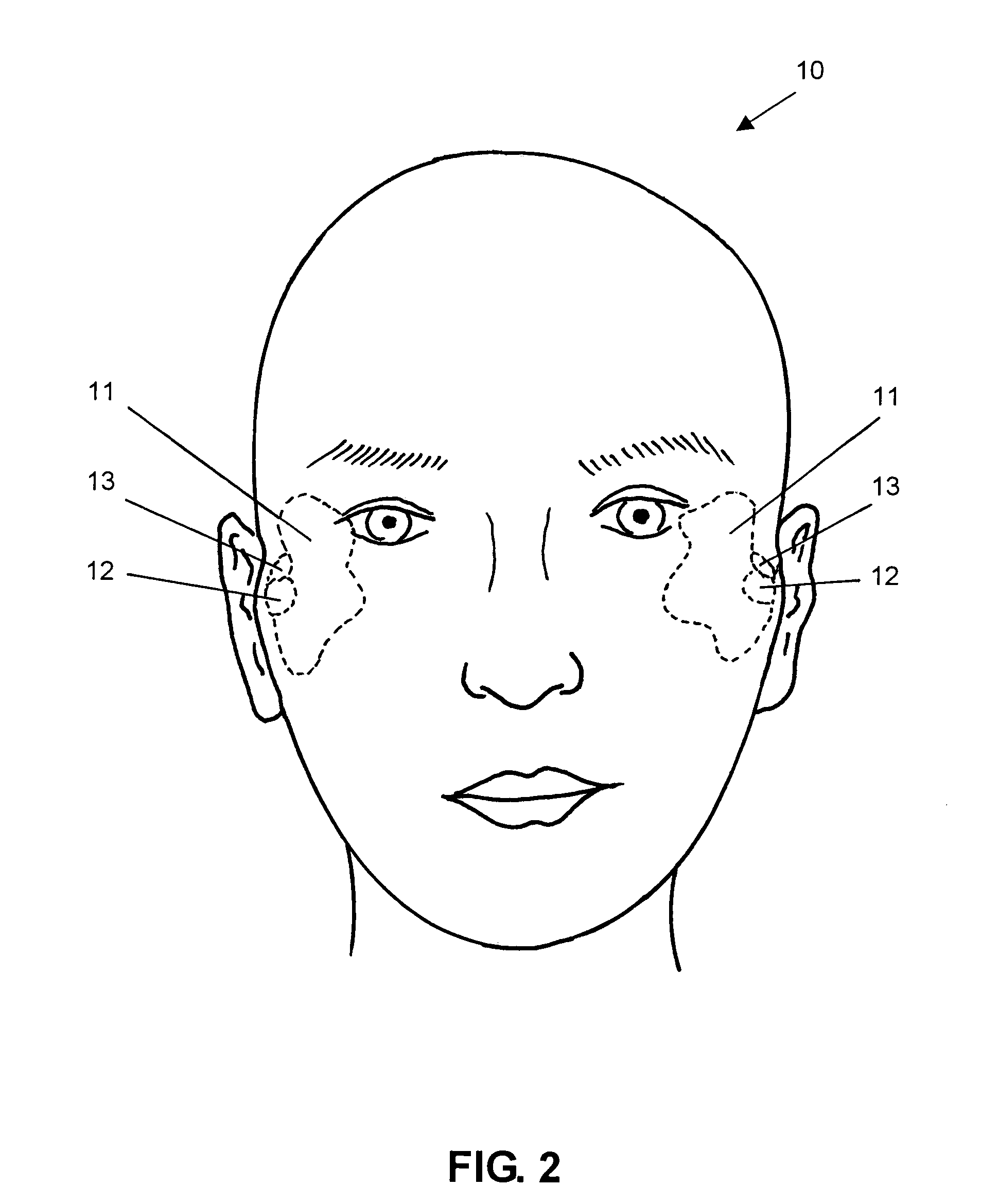 Eyeglass structures having mounting supports in temple members