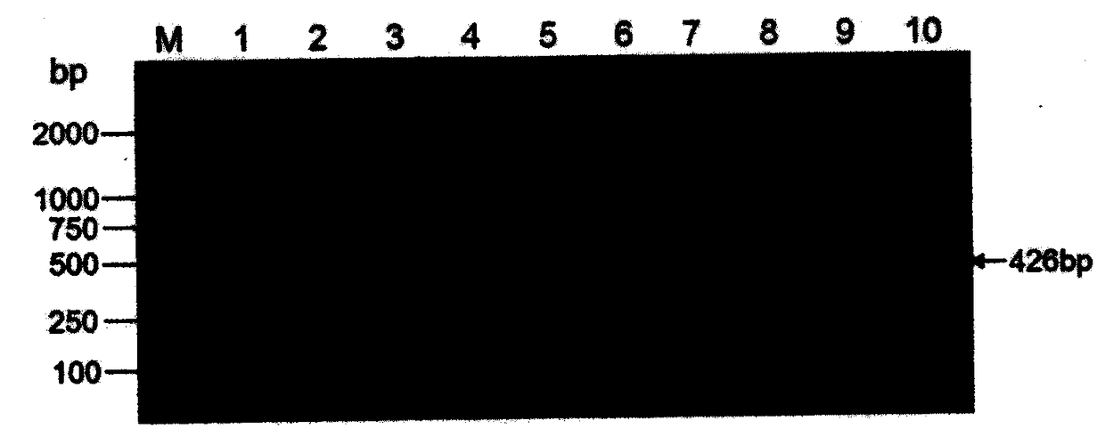 Flanking sequence of disease-resistant transgenic soybean event B5B9104-3 exogenous insertion element and application thereof