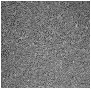 Method for preparing clinical-level adipose-derived stem cells