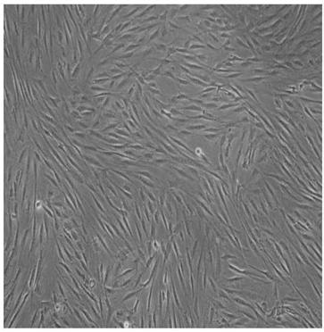 Method for preparing clinical-level adipose-derived stem cells