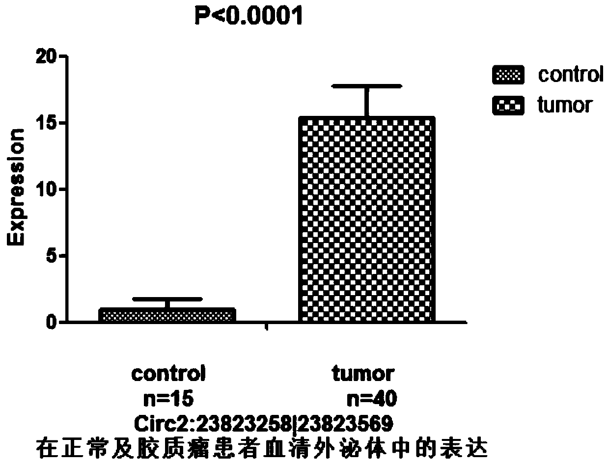 Glioma diagnostic marker circ2:23823258|23823569 and its application