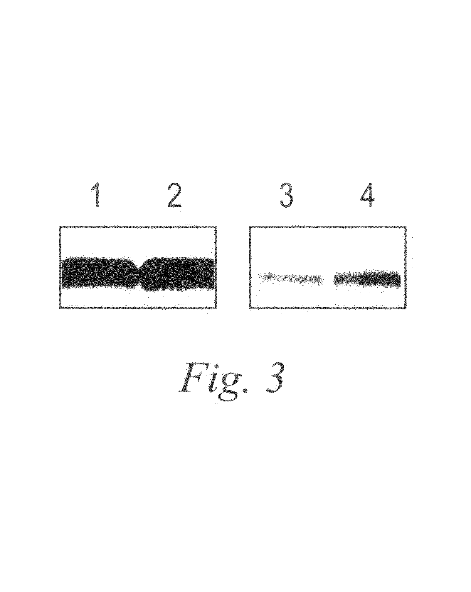 Monoclonal antibodies specific for the extracellular domain of prostate-specific membrane antigen