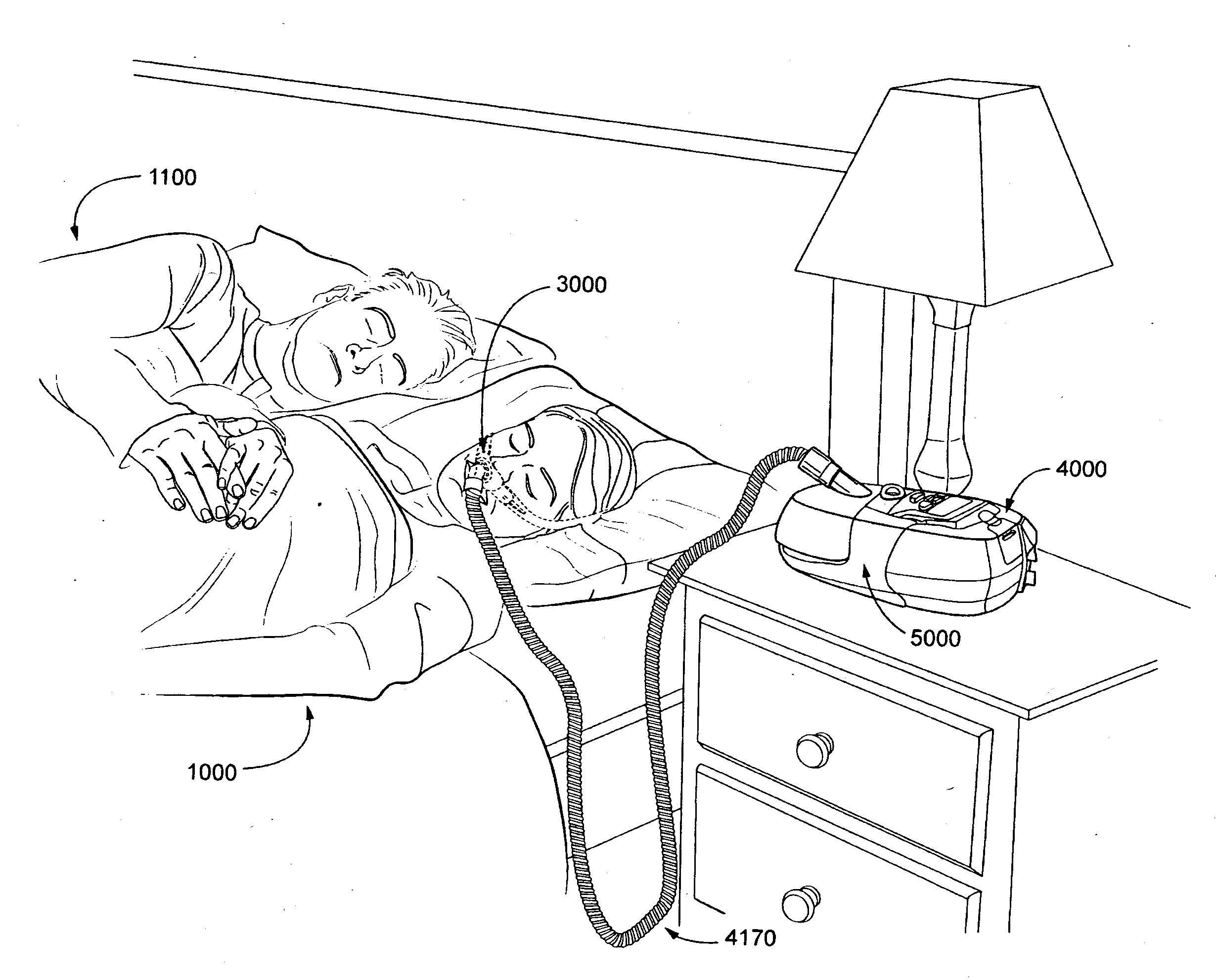 Nasal mask system