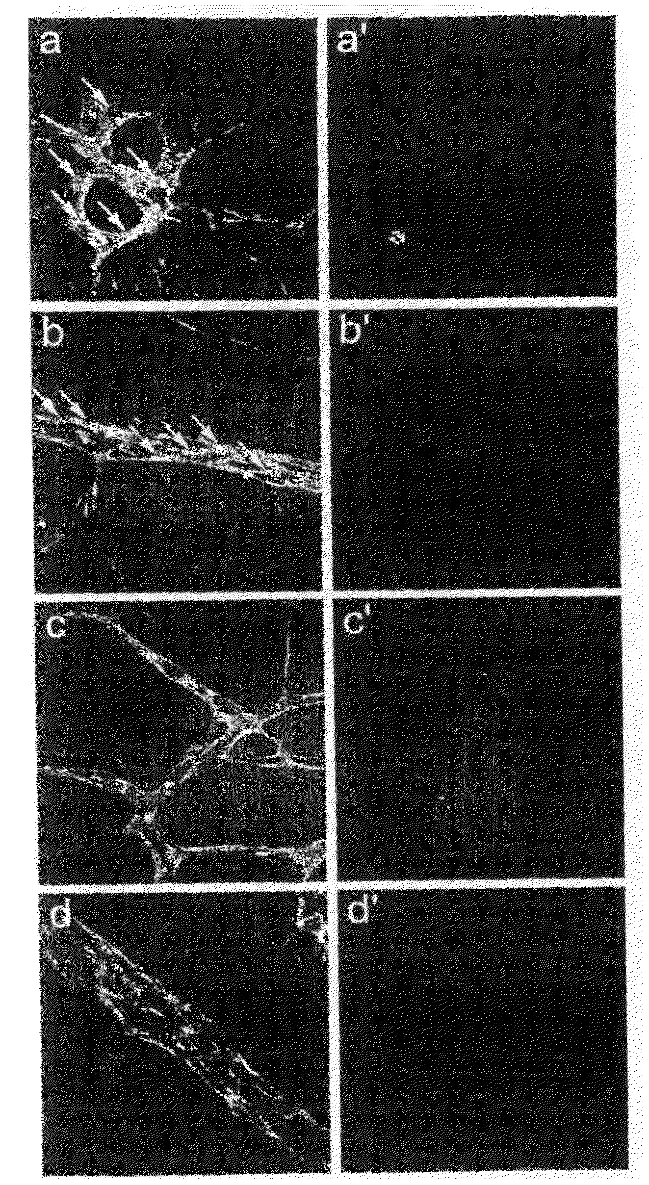 DLL4 Signaling Inhibitors and Uses Thereof