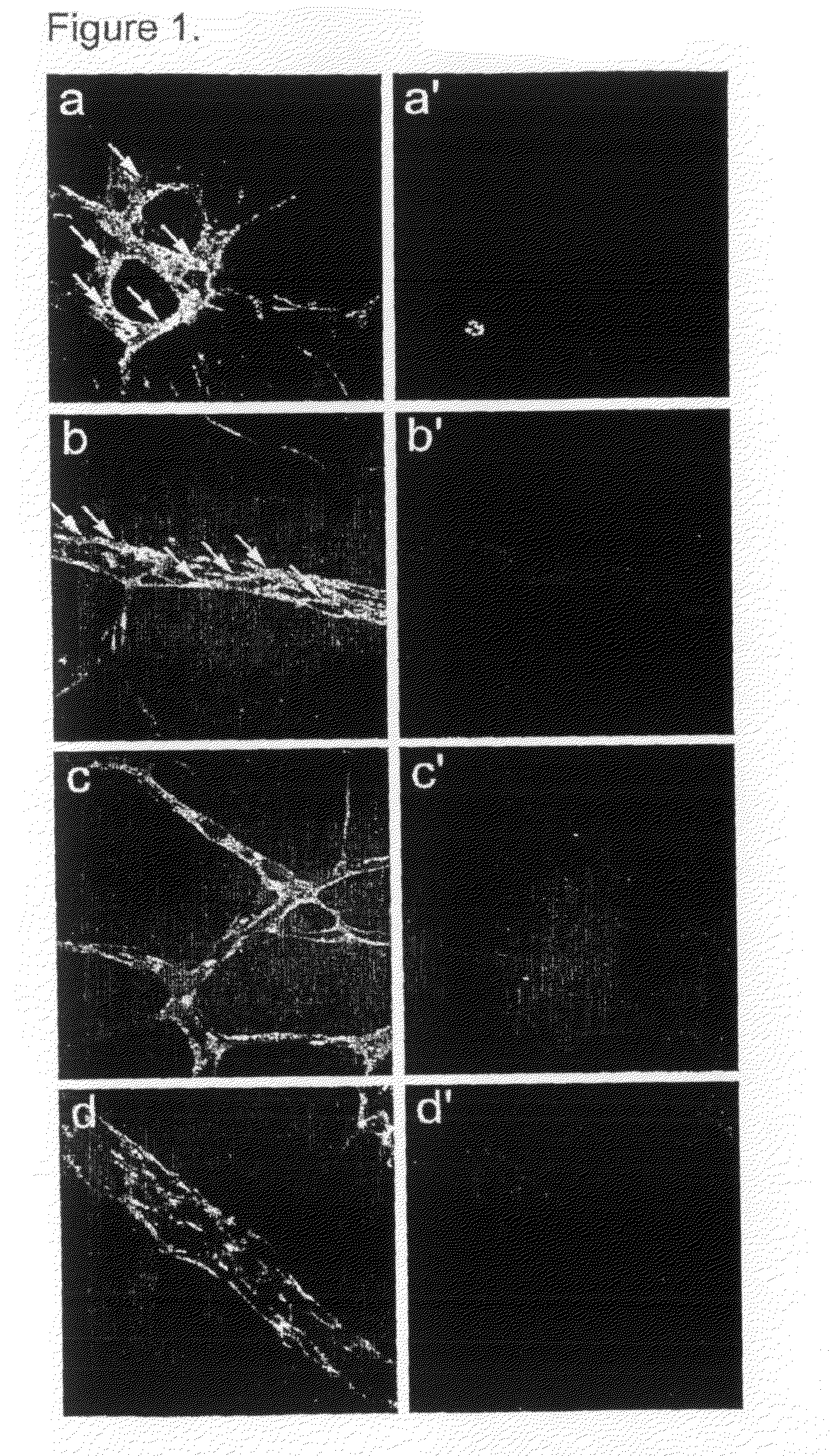 DLL4 Signaling Inhibitors and Uses Thereof