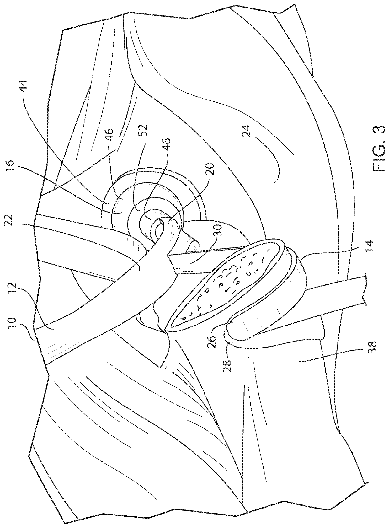 Orthopedic Retractor For Hip Replacement