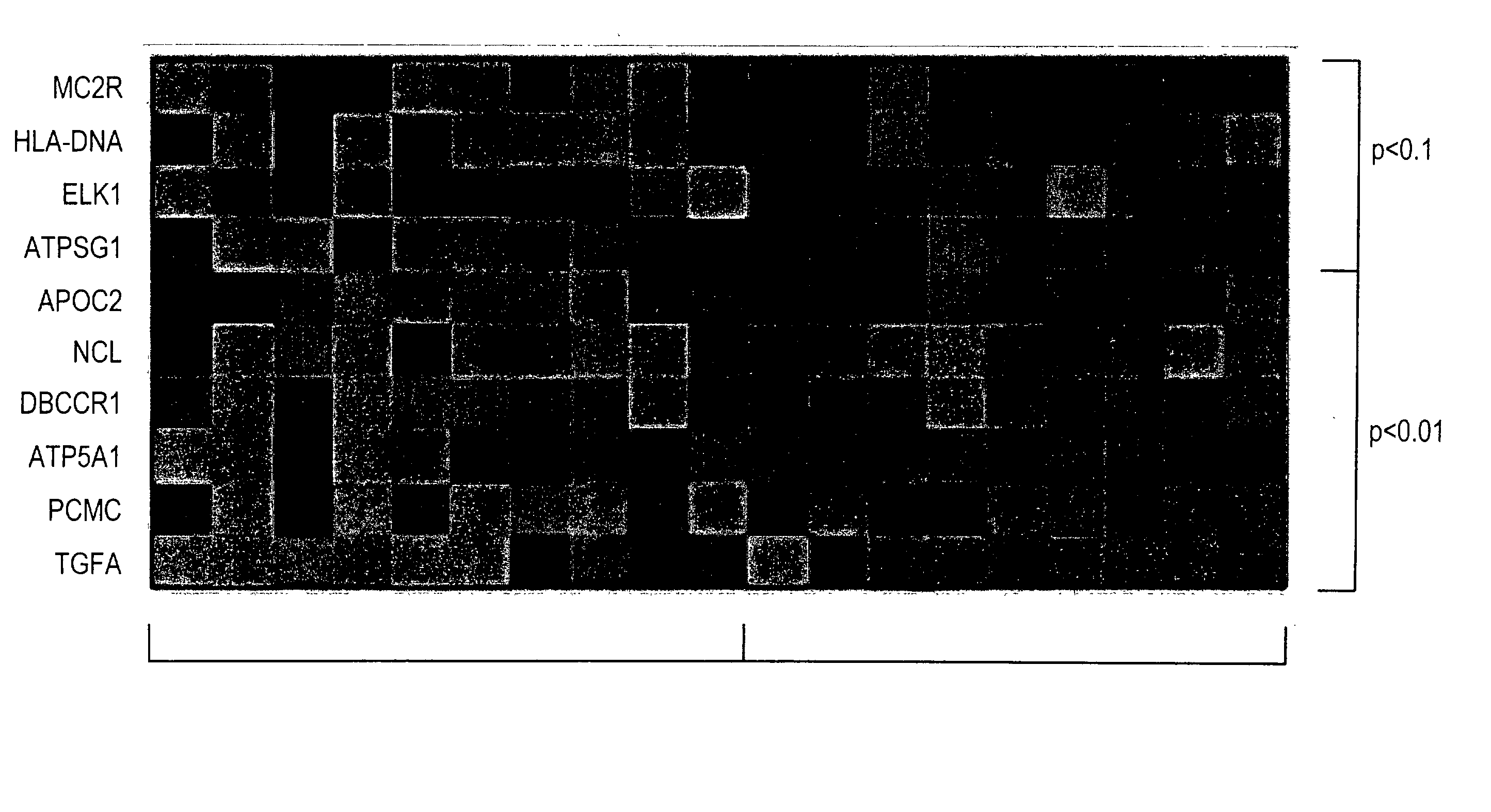 Method and nucleic acids for the differentiation of prostate tumors