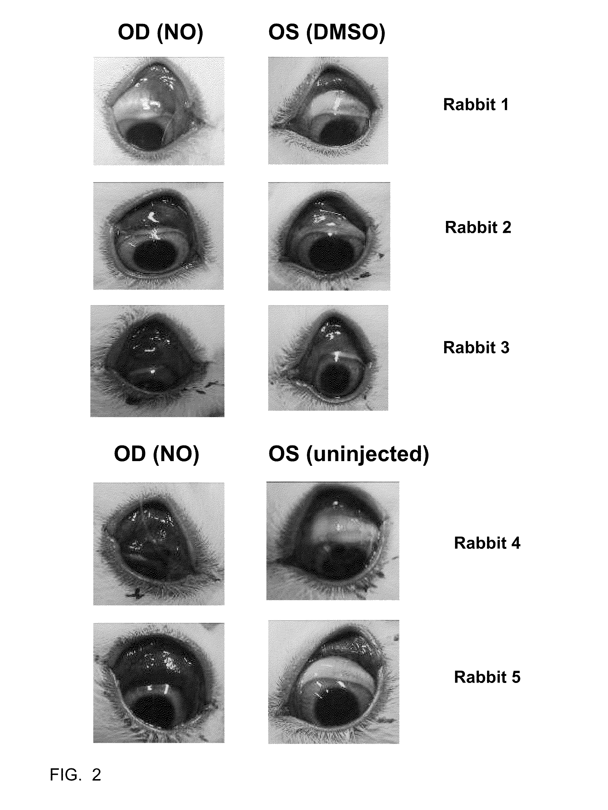 Treatment of Ocular Surface Disorders by Increasing Conjunctival Vascular Permeability