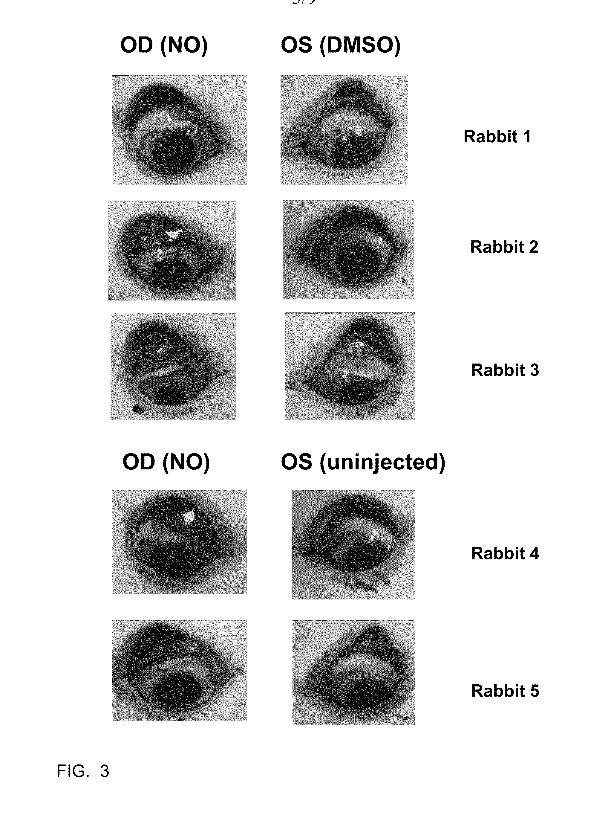 Treatment of Ocular Surface Disorders by Increasing Conjunctival Vascular Permeability