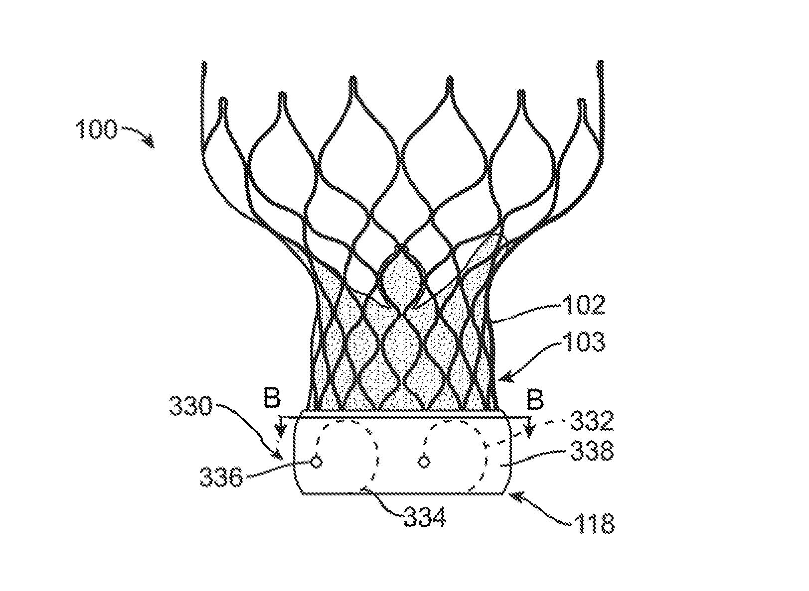 Anti-paravalvular leakage component for a transcatheter valve prosthesis