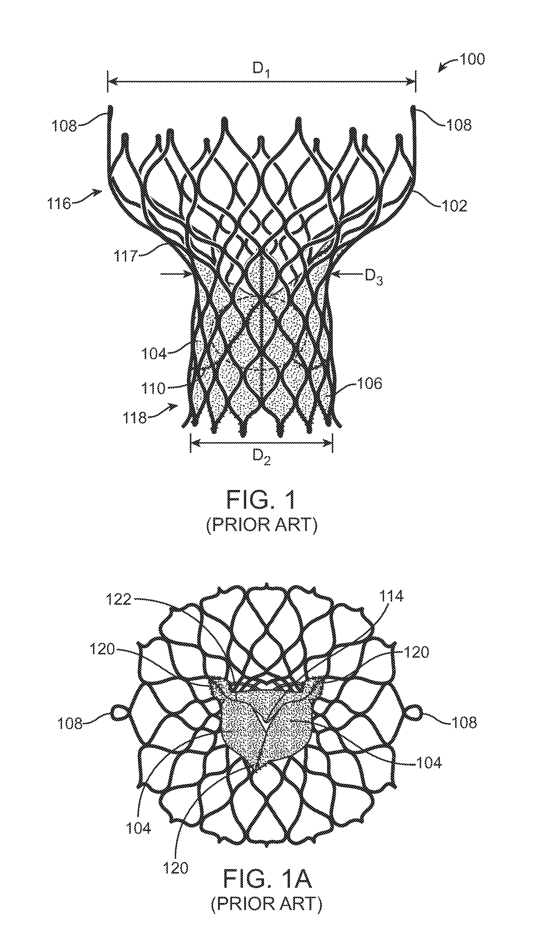 Anti-paravalvular leakage component for a transcatheter valve prosthesis