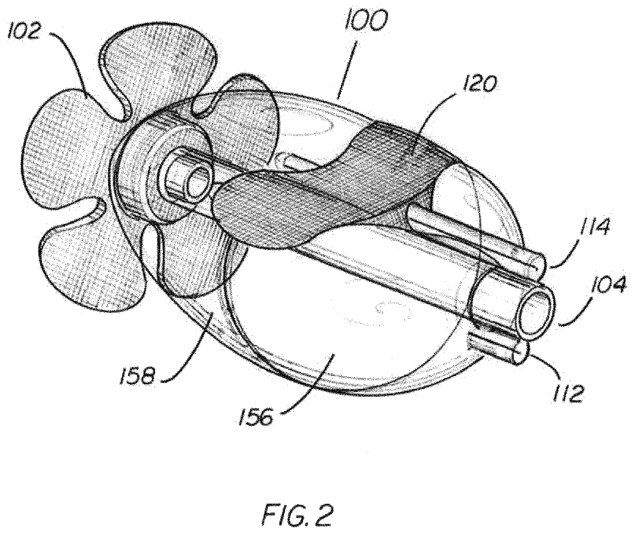 Cervical stabilization device