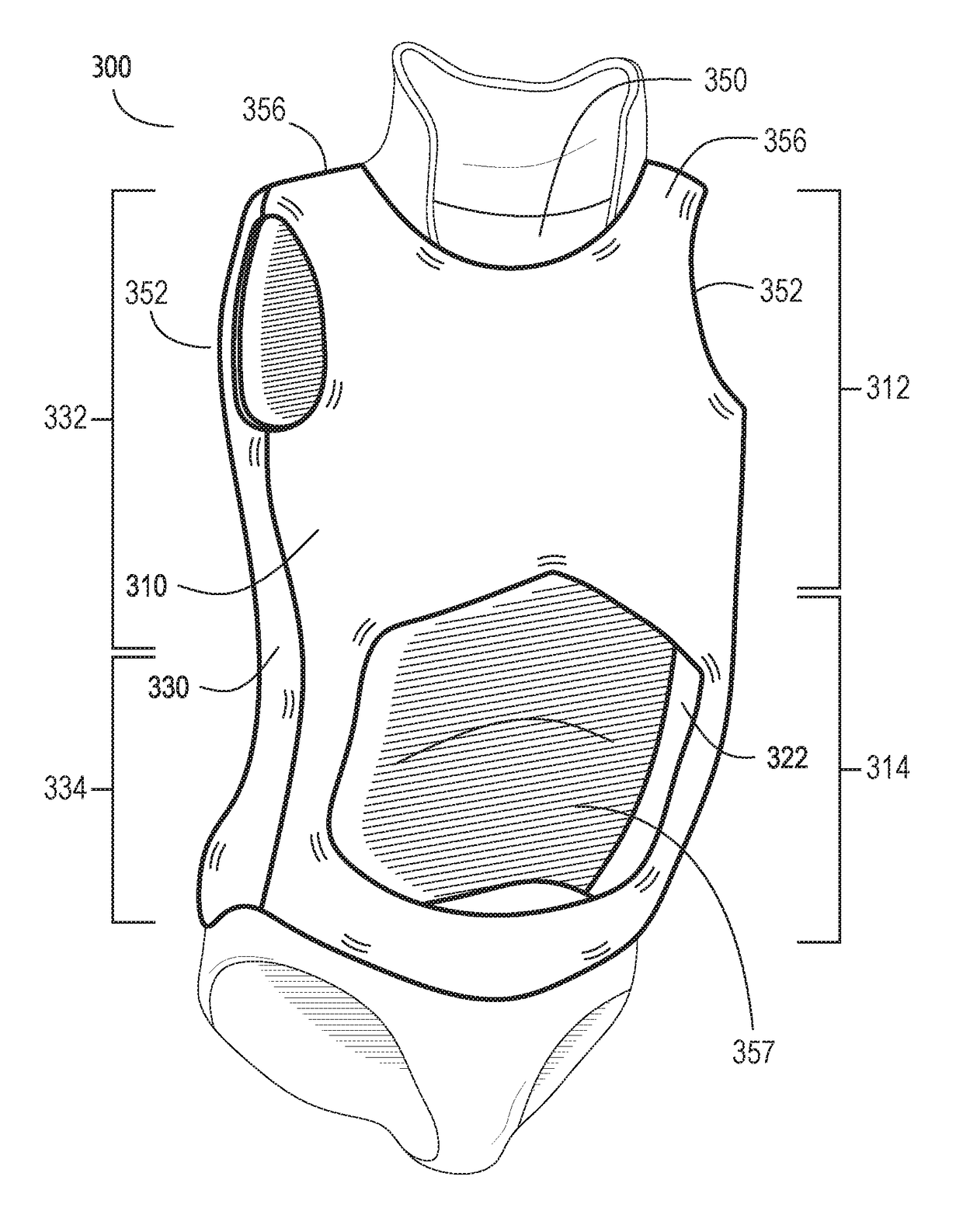 Scoliosis treatment system and method