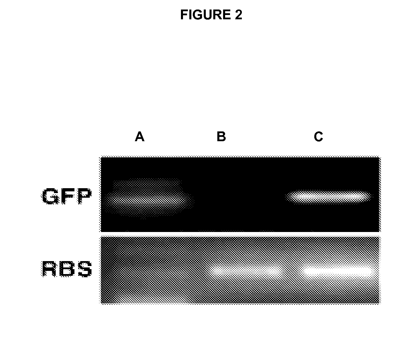 Gene therapy compositions for preventing and/or treating of autoimmune diseases