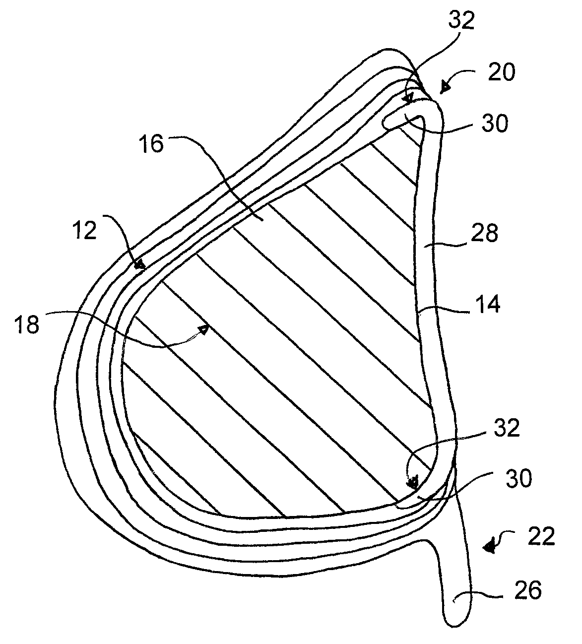 Method of forming a breast prosthesis