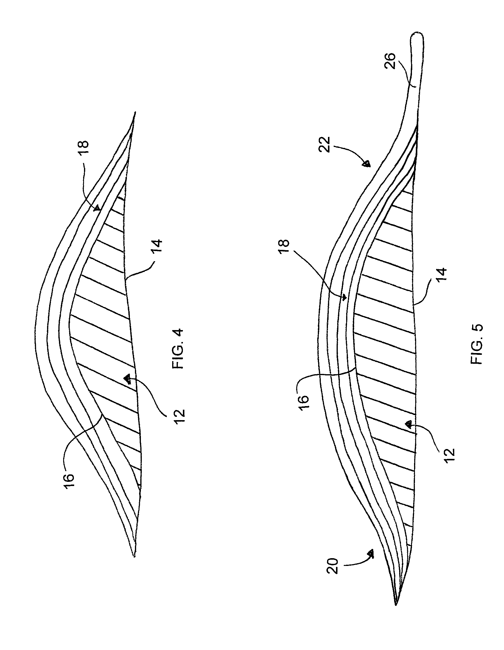 Method of forming a breast prosthesis