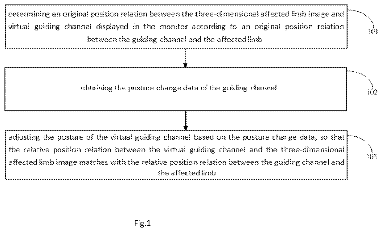 Posture Display Method, Device and System of Guiding Channel, and Readable Storage Medium