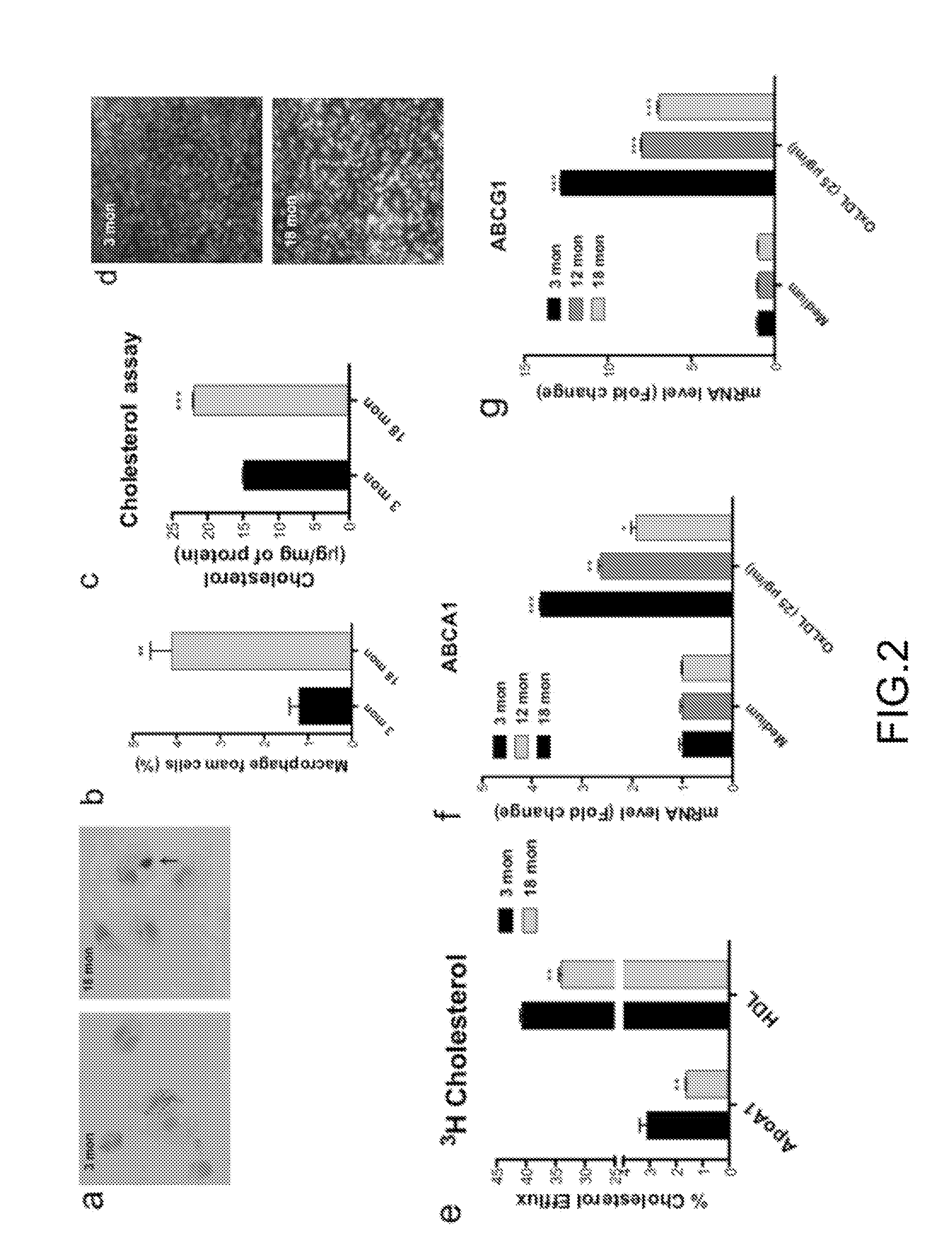 Inhibition of choroidal neovascularization