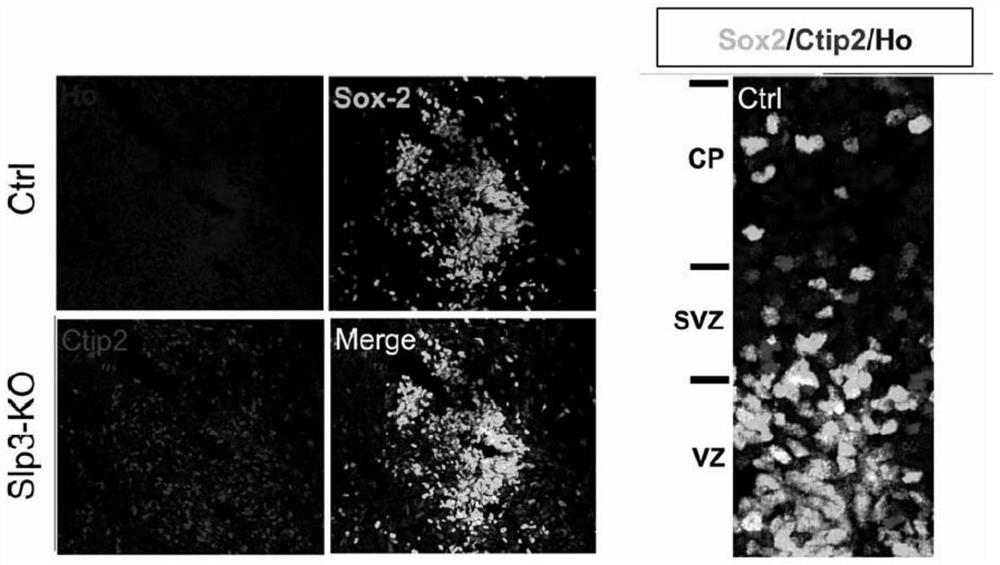 Method for constructing brain-like tissue using umbilical cord mesenchymal stem cells