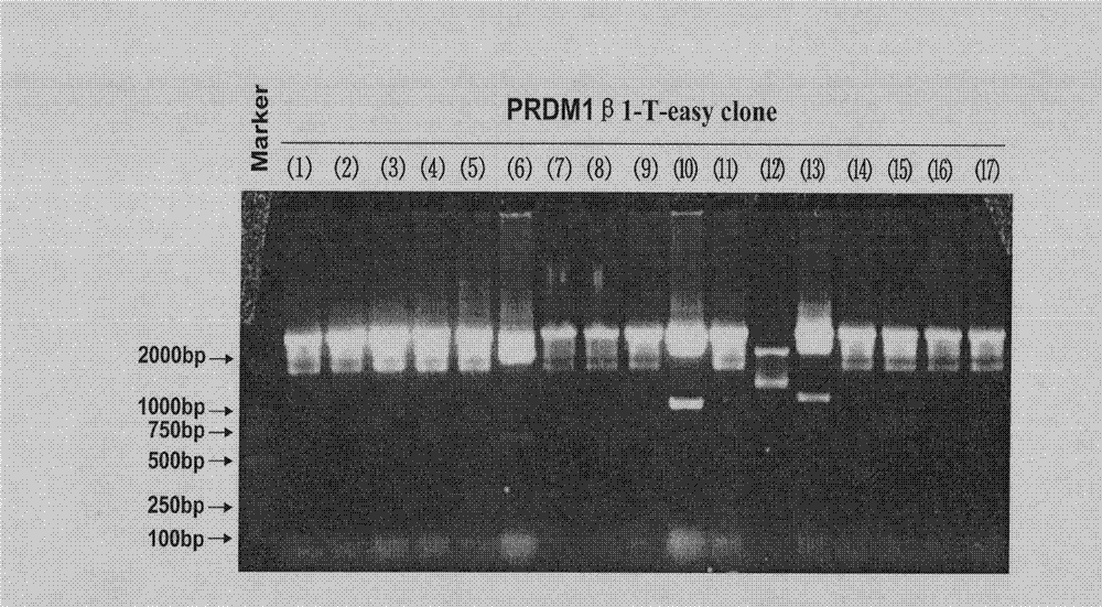 Group of siRNA molecules capable of effectively reducing PRDM1beta expression and application thereof