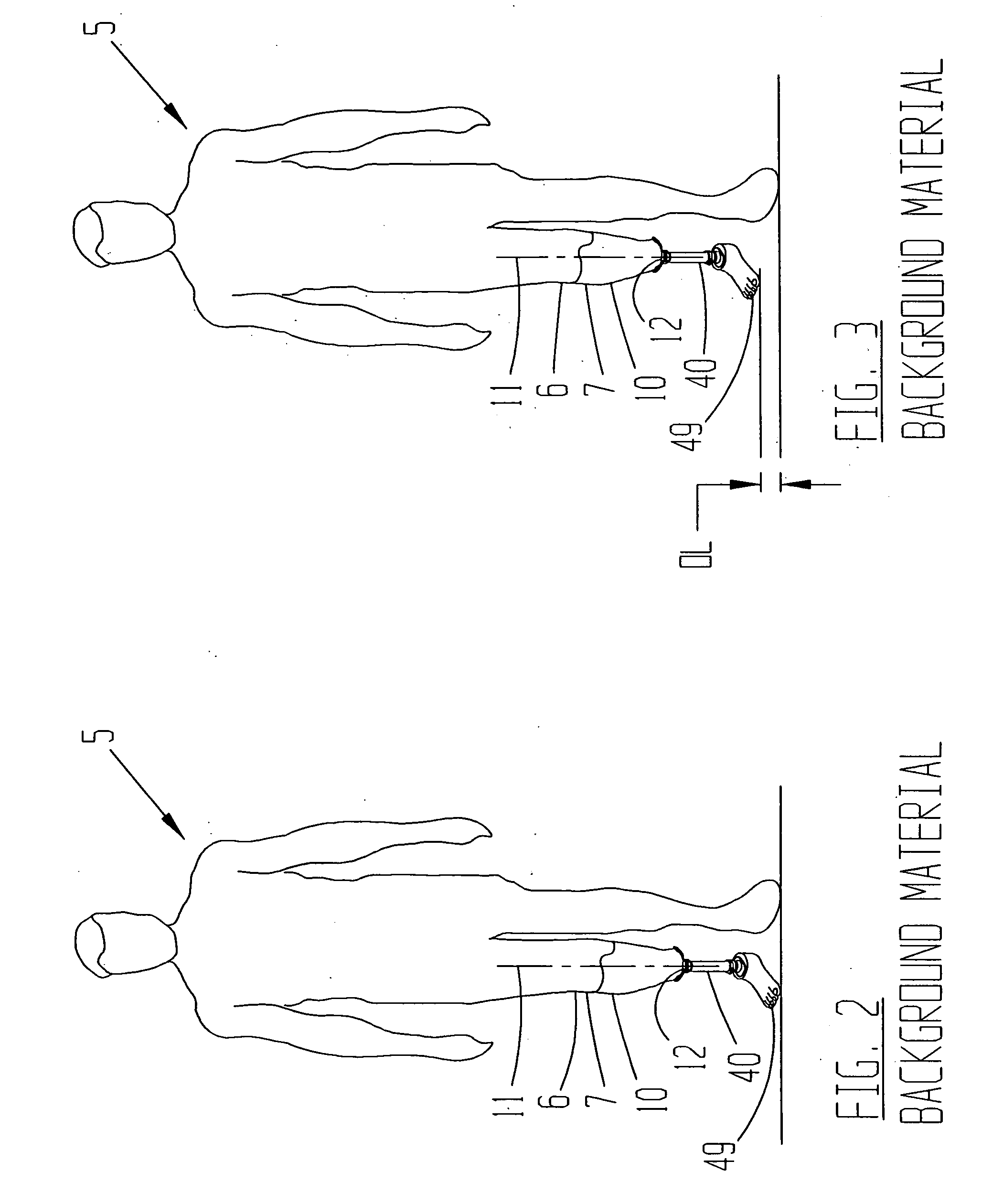 Limb with modular prosthetic components