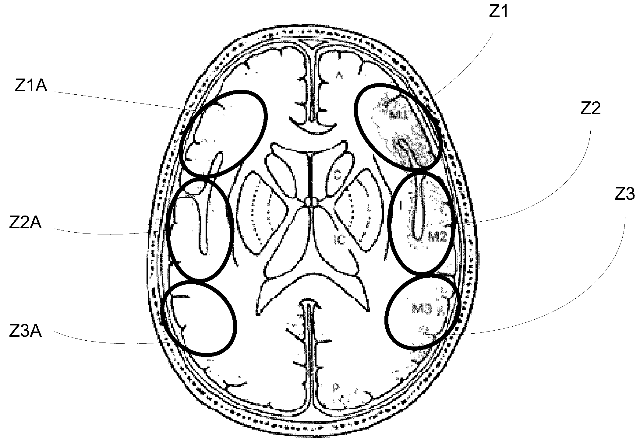 Systems and methods for diagnosing strokes