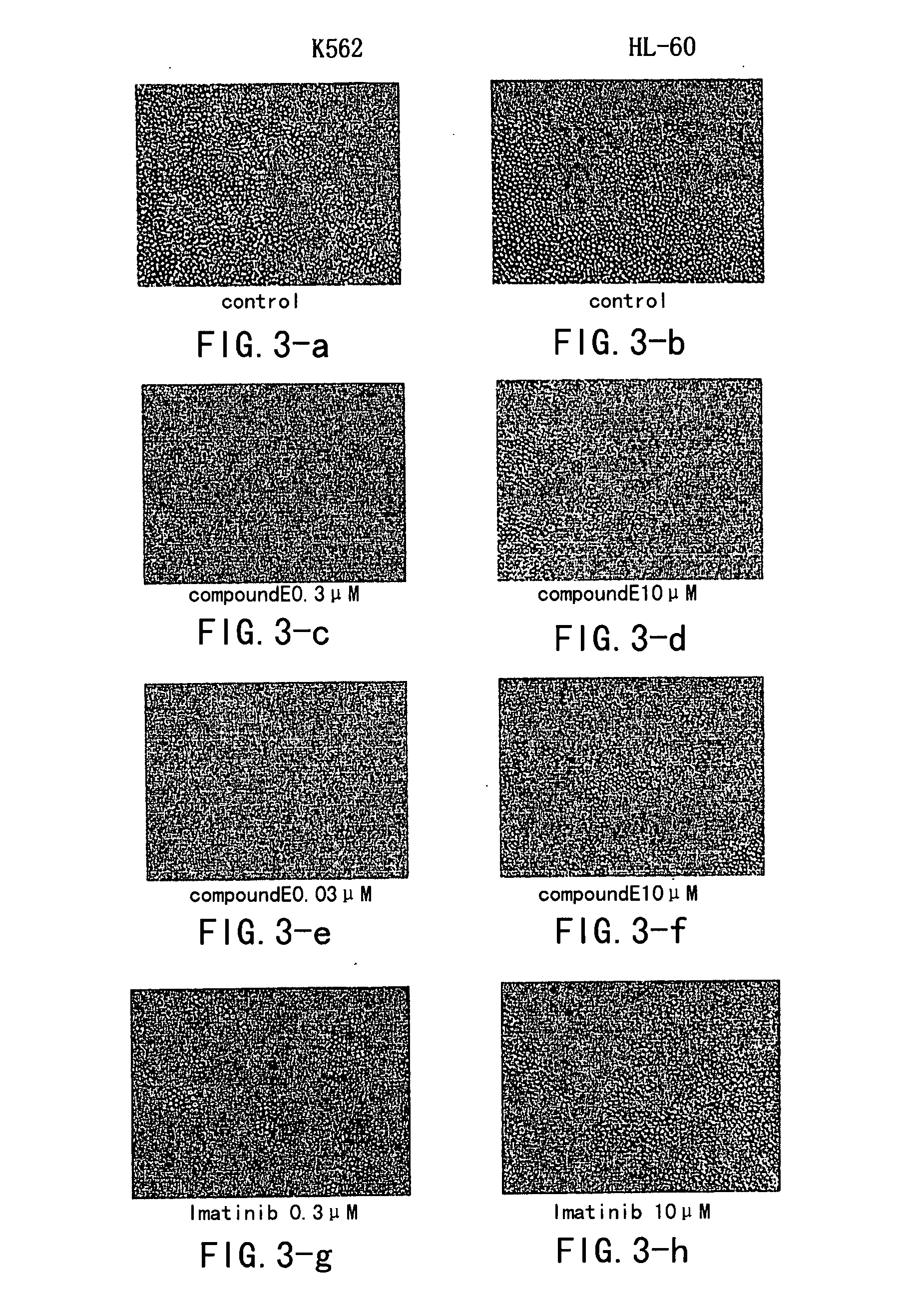 Aminopyrimidine Compounds and Their Salts, Process for Preparation and Pharmaceutical Use Thereof