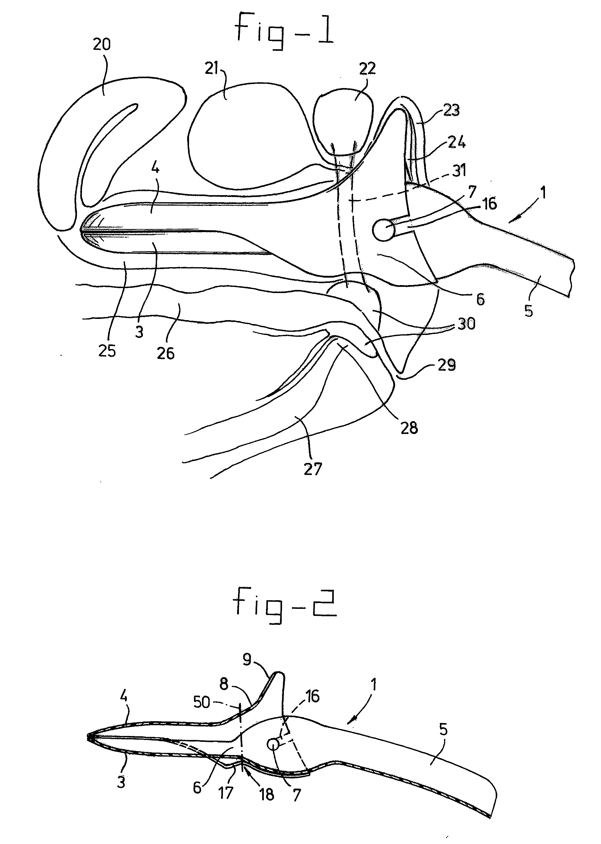 Vaginal speculum