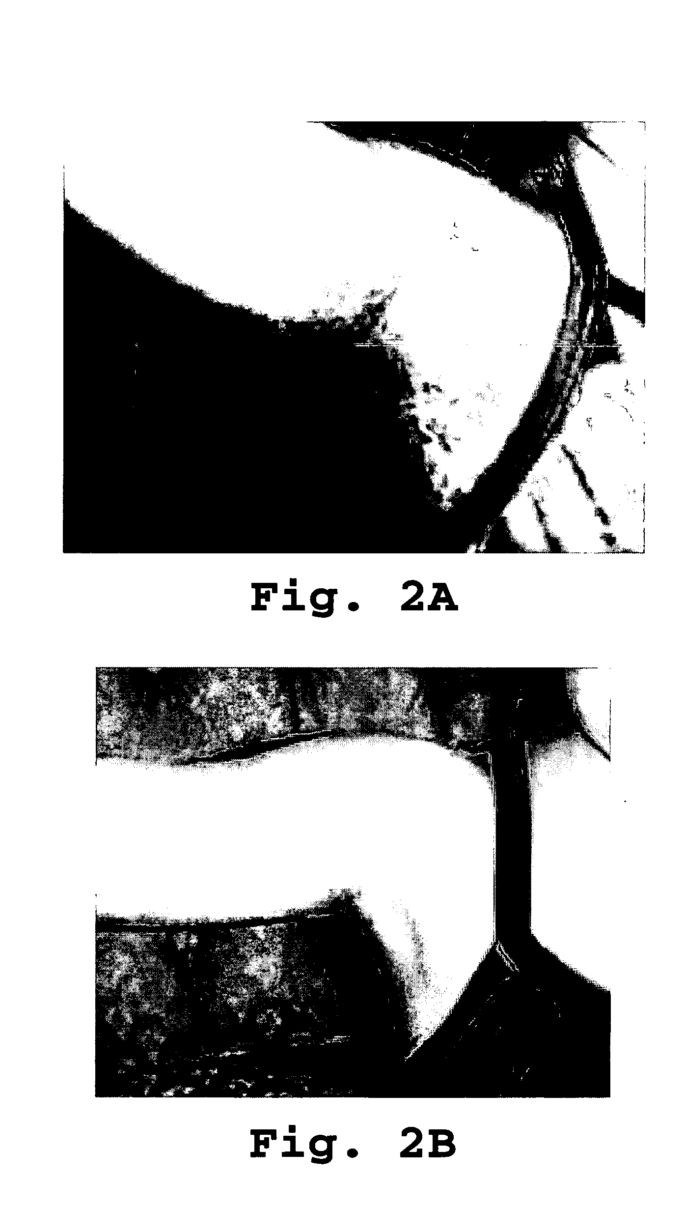 Compositions for treatment of viral-induced skin lesions and methods of using same