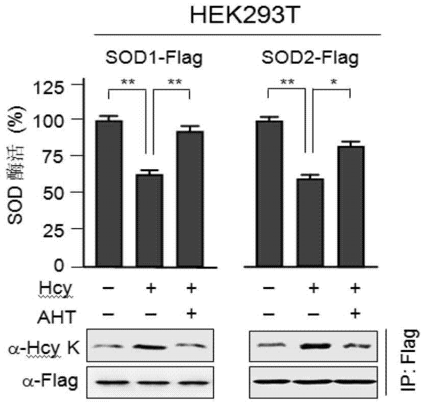 Hcy structural analog aht that inhibits methionyl-tRNA synthetase to produce htl and its application