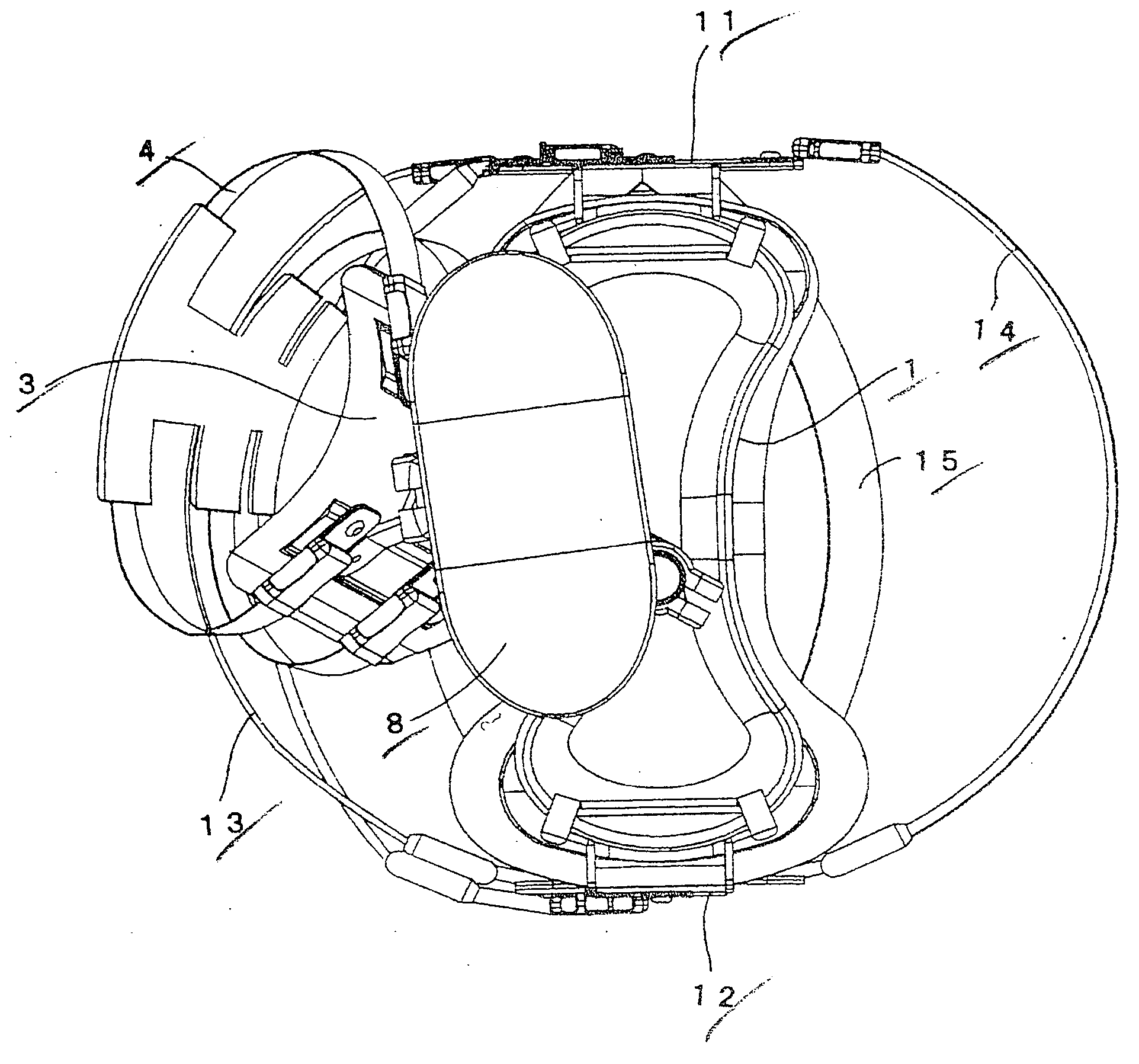 Hucklebone supporting-type artificial leg