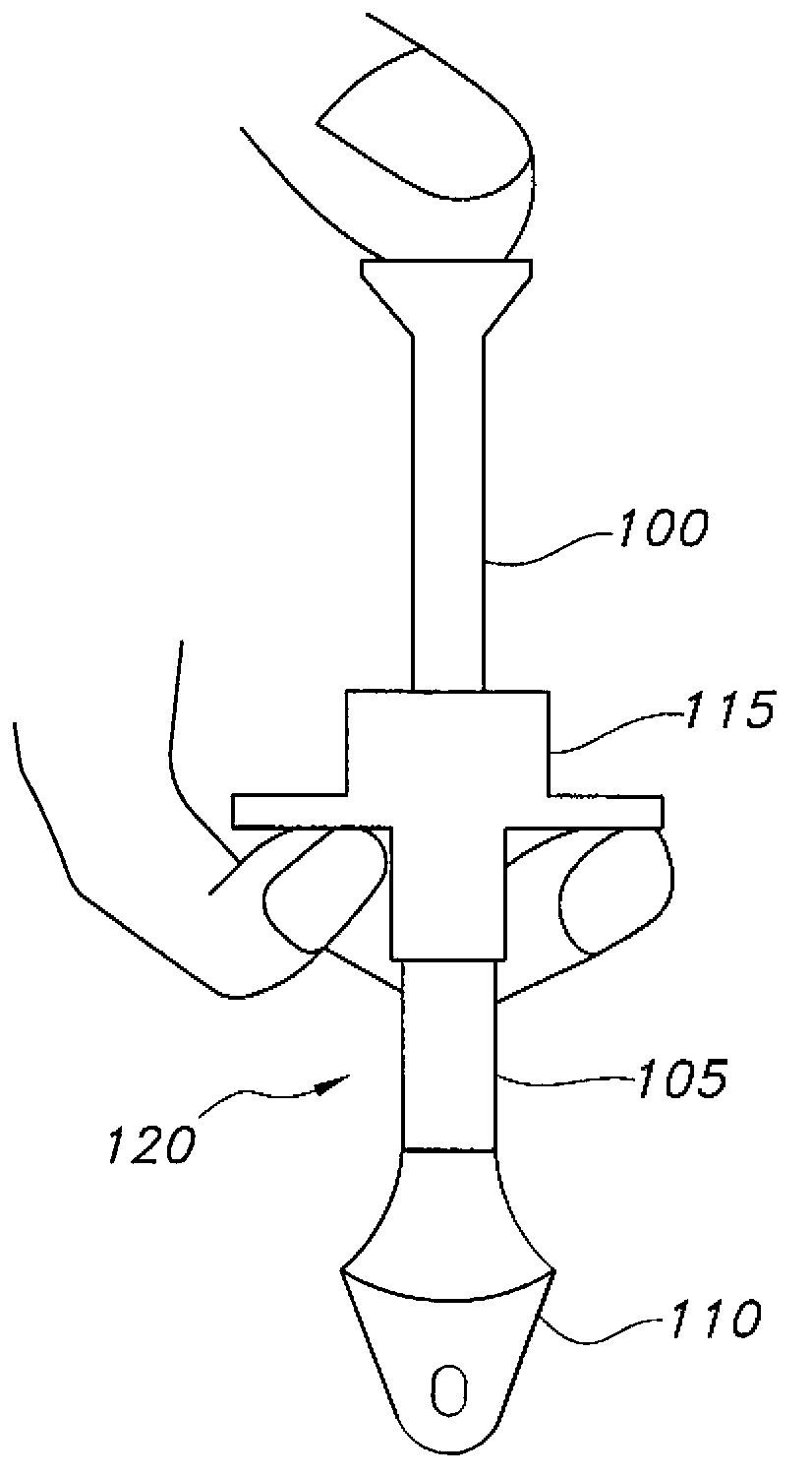 Configurable percutaneous endoscopic gastrostomy tube