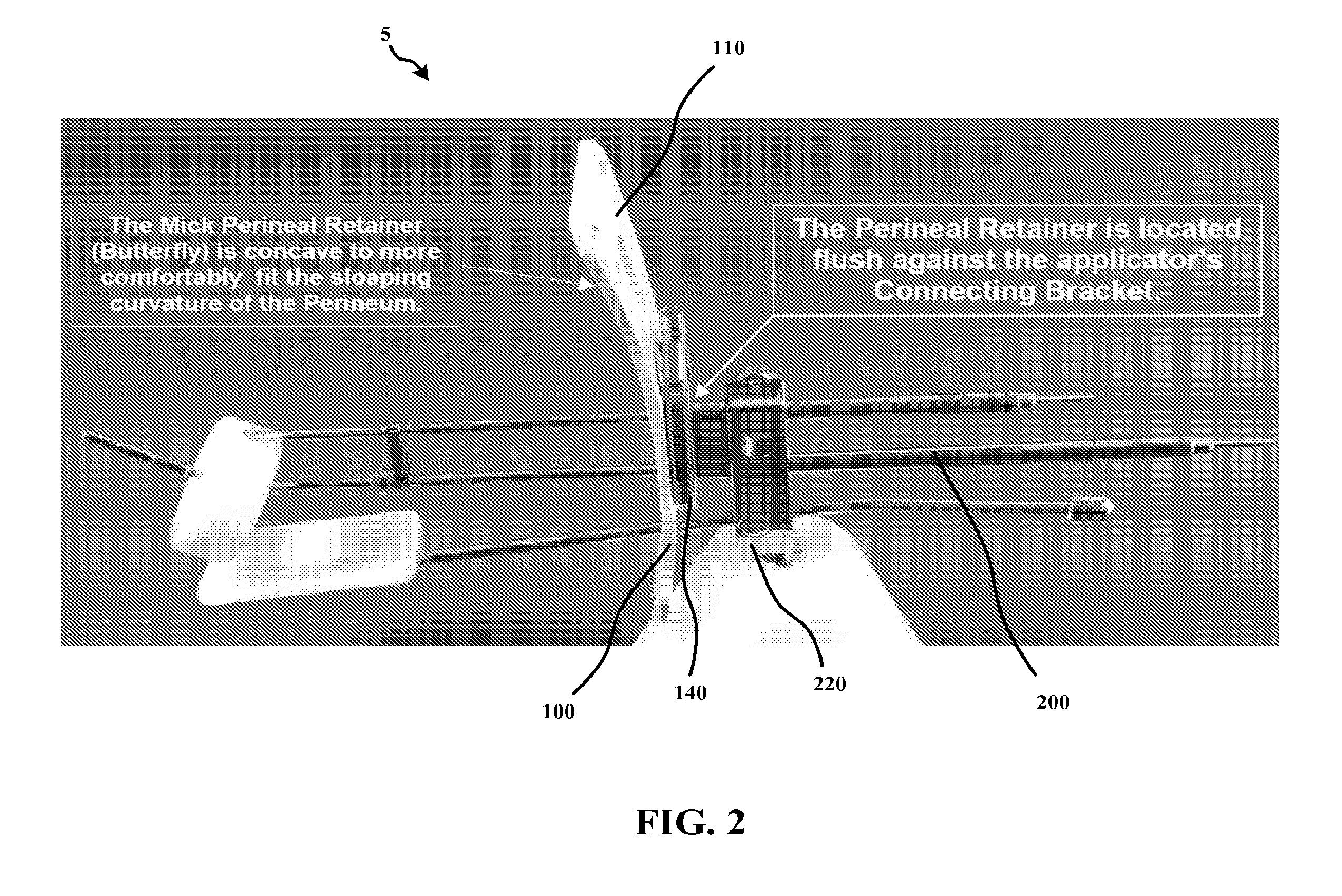 Brachytherapy Device and Method