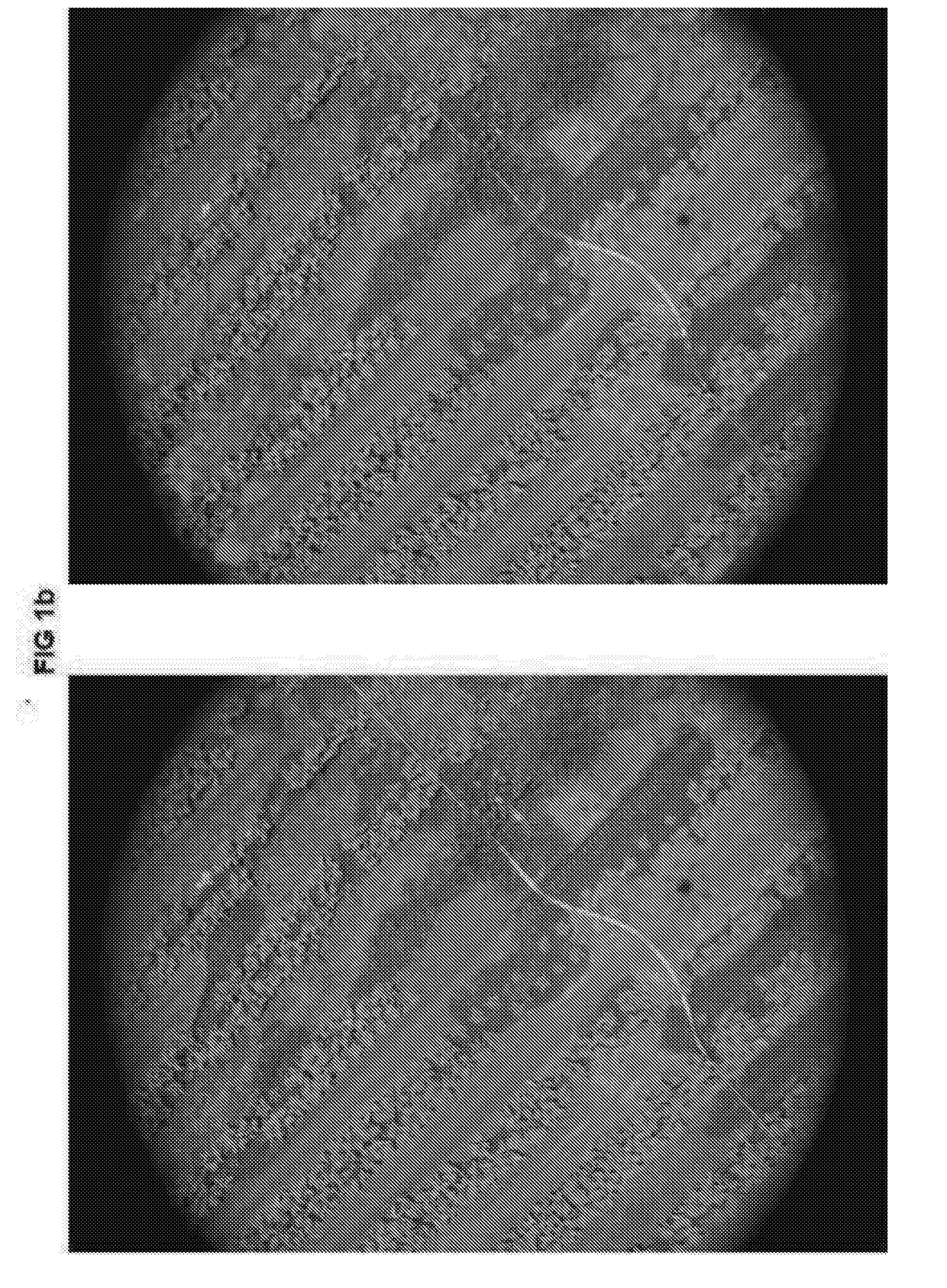 Method for aerial imagery acquisition and analysis