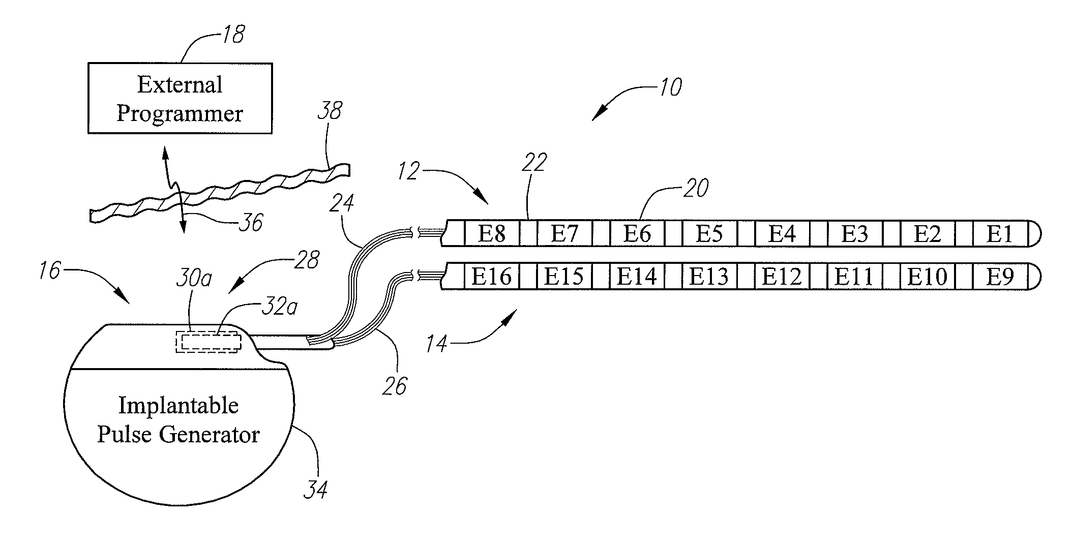 System and method for computationally determining migration of neurostimulation leads