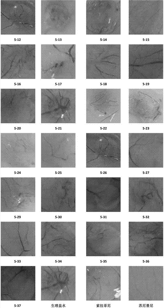 Compound capable of inhibiting conduction of vascular endothelial growth factor receptor signal