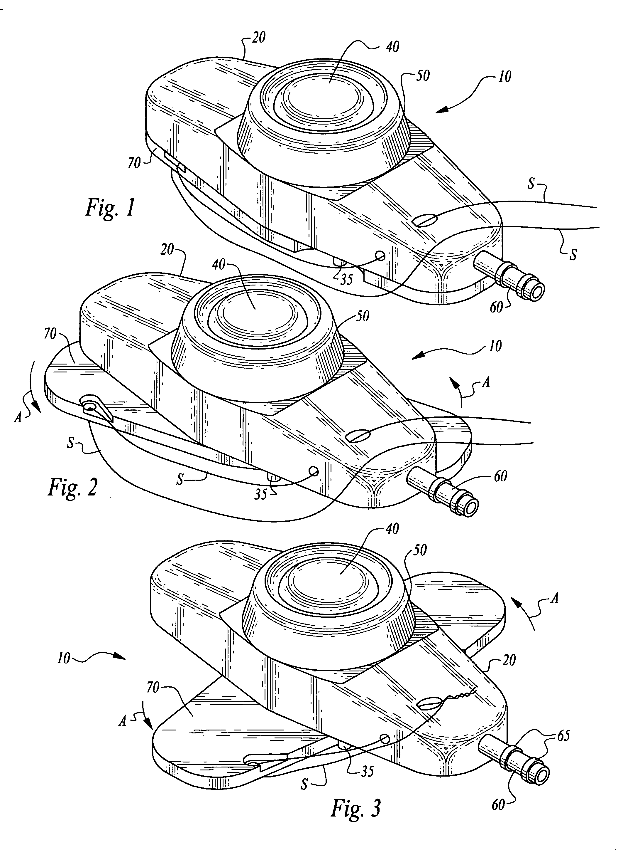 Stabilized implantable vascular access port